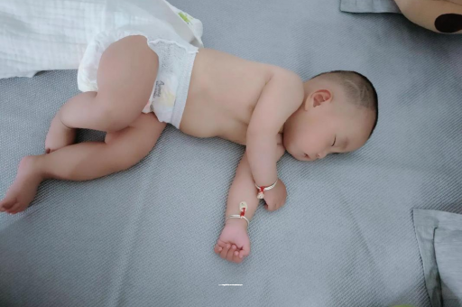 嵊州六个月宝宝眼睛散光